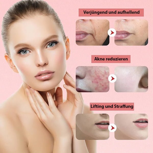Face Lifting Massager