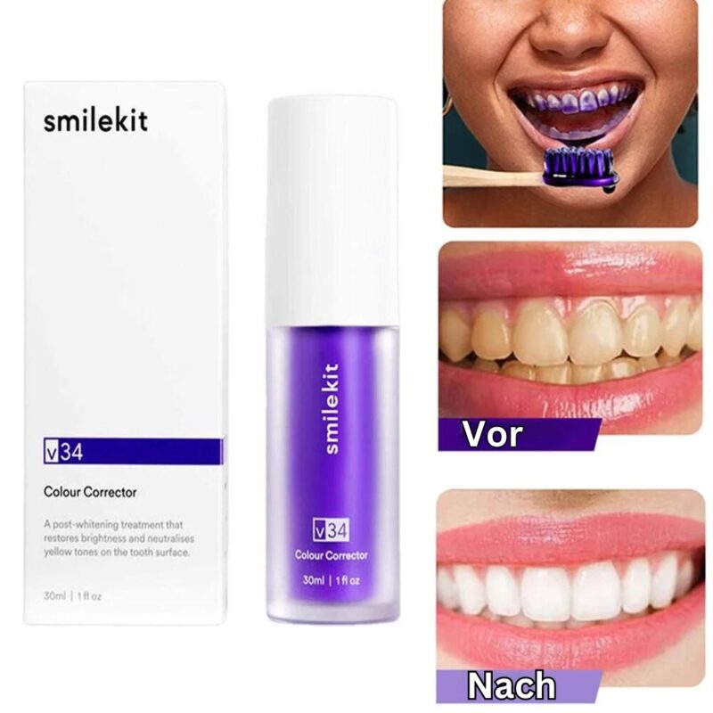 HelvetiaLächele – Zähni-Blitz Kit - Image 5